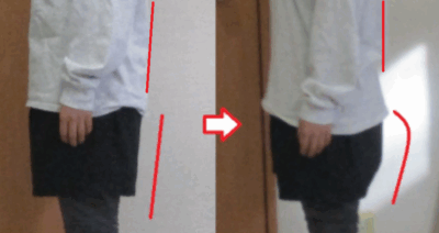 反り腰
